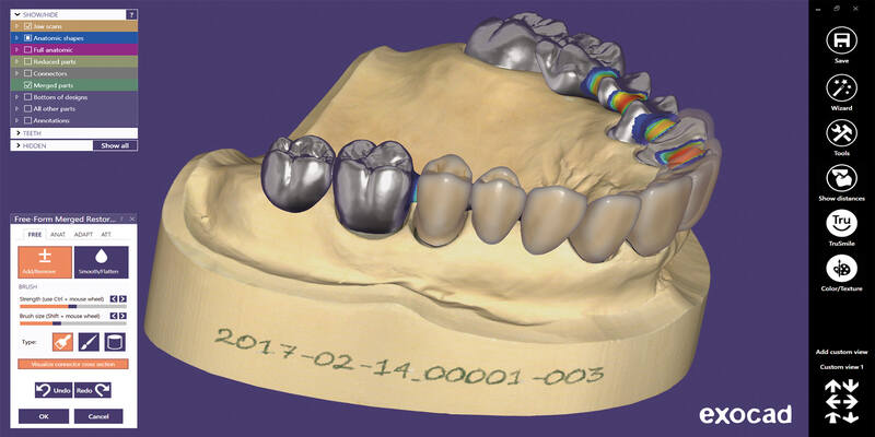 Exocad CAD CAM software